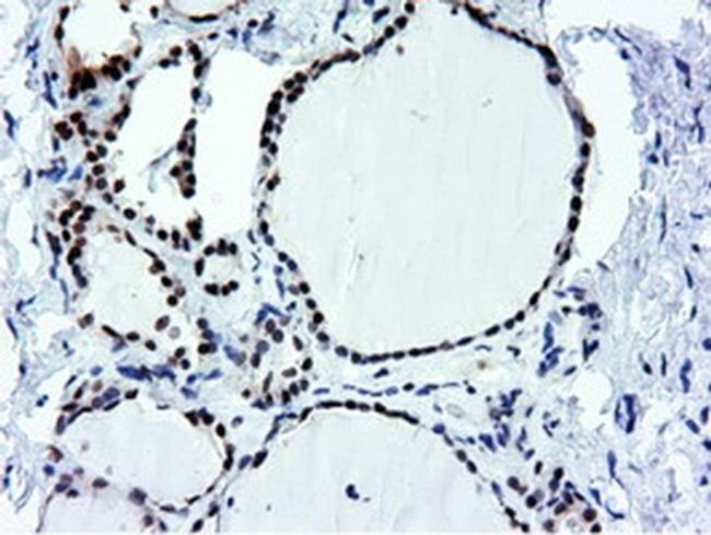 NT5D1 Antibody in Immunohistochemistry (Paraffin) (IHC (P))