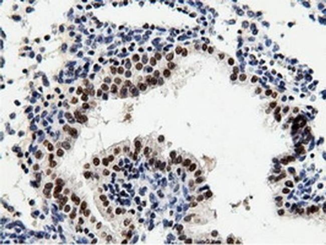 NT5D1 Antibody in Immunohistochemistry (Paraffin) (IHC (P))