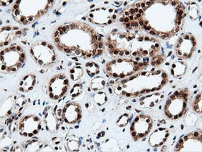 NT5D1 Antibody in Immunohistochemistry (Paraffin) (IHC (P))