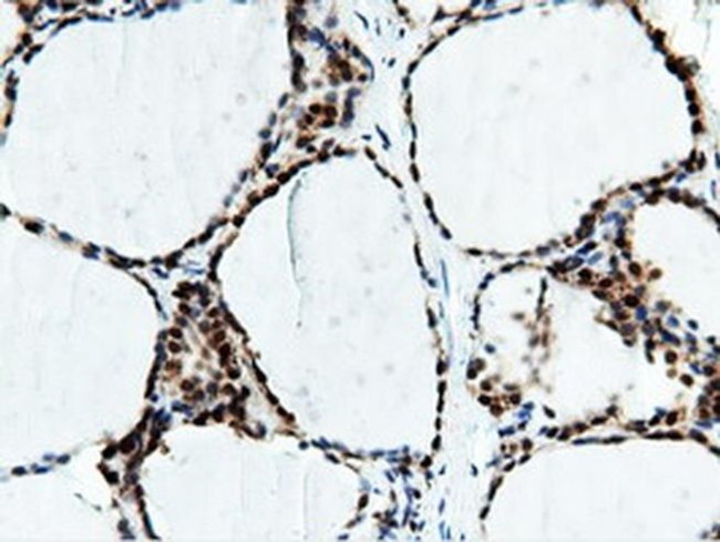 NT5D1 Antibody in Immunohistochemistry (Paraffin) (IHC (P))