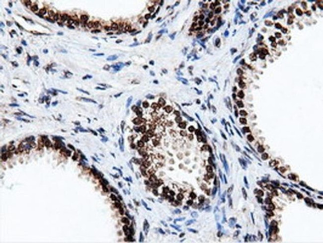 NT5D1 Antibody in Immunohistochemistry (Paraffin) (IHC (P))