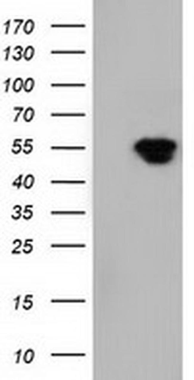 NT5D1 Antibody in Western Blot (WB)