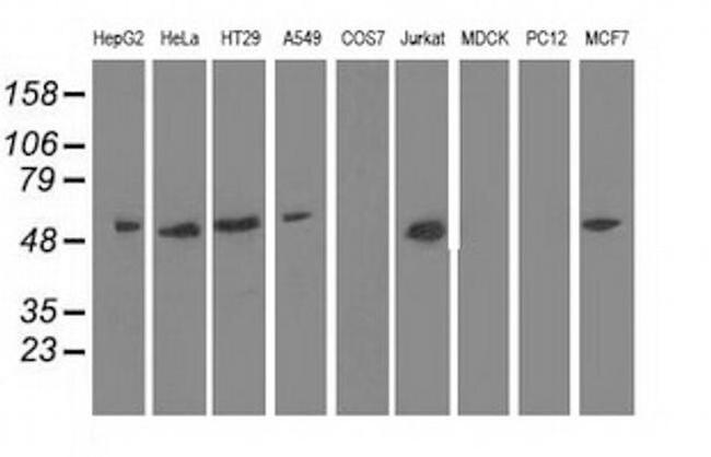 NT5D1 Antibody in Western Blot (WB)