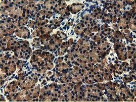 EPHX2 Antibody in Immunohistochemistry (Paraffin) (IHC (P))