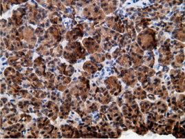 EPHX2 Antibody in Immunohistochemistry (Paraffin) (IHC (P))