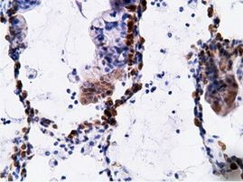 EPHX2 Antibody in Immunohistochemistry (Paraffin) (IHC (P))