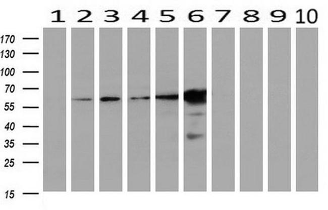 EPHX2 Antibody in Western Blot (WB)