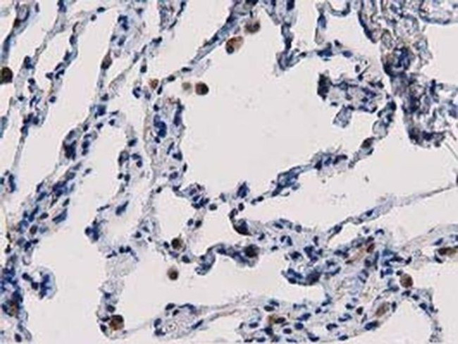 PEPD Antibody in Immunohistochemistry (Paraffin) (IHC (P))