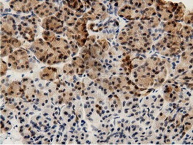 Adenylate Kinase 5 Antibody in Immunohistochemistry (Paraffin) (IHC (P))