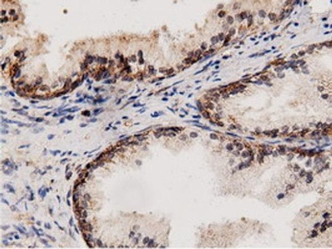 Adenylate Kinase 5 Antibody in Immunohistochemistry (Paraffin) (IHC (P))