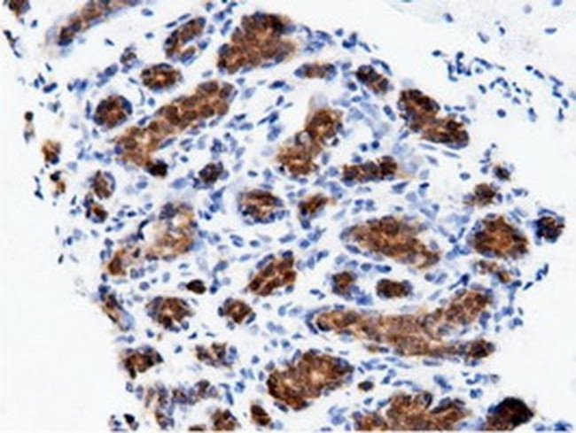 Adenylate Kinase 5 Antibody in Immunohistochemistry (Paraffin) (IHC (P))