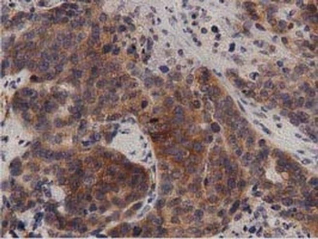 PRKD2 Antibody in Immunohistochemistry (Paraffin) (IHC (P))