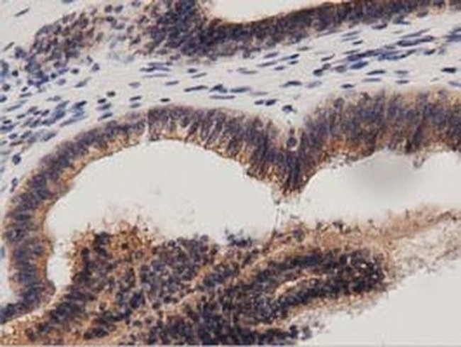 PRKD2 Antibody in Immunohistochemistry (Paraffin) (IHC (P))