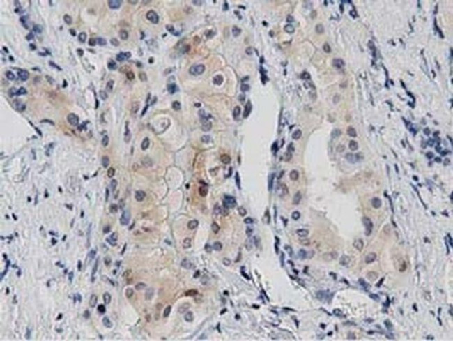 PRKD2 Antibody in Immunohistochemistry (Paraffin) (IHC (P))