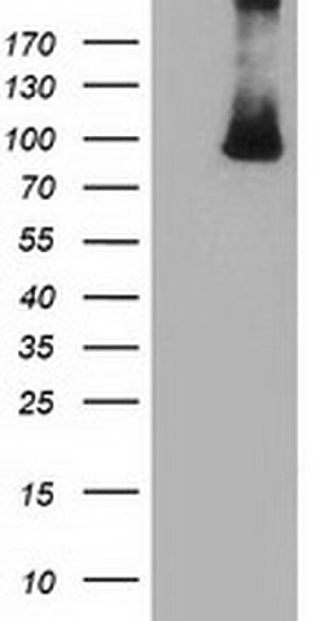 PRKD2 Antibody in Western Blot (WB)