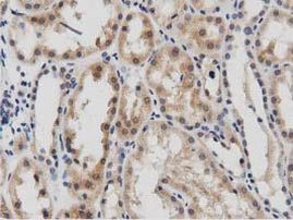 DNAJA2 Antibody in Immunohistochemistry (Paraffin) (IHC (P))