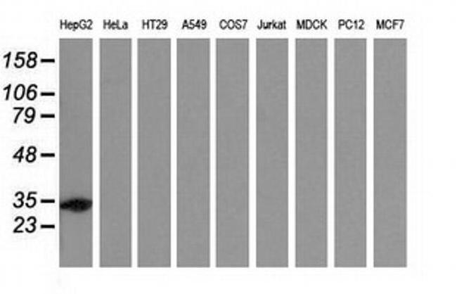 SULT2A1 Antibody in Western Blot (WB)