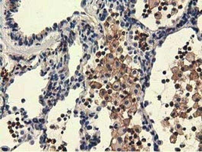 UHMK1 Antibody in Immunohistochemistry (Paraffin) (IHC (P))