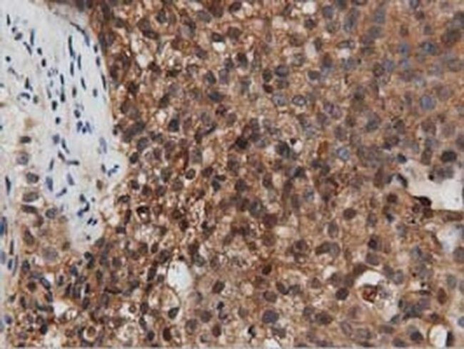 PEPD Antibody in Immunohistochemistry (Paraffin) (IHC (P))