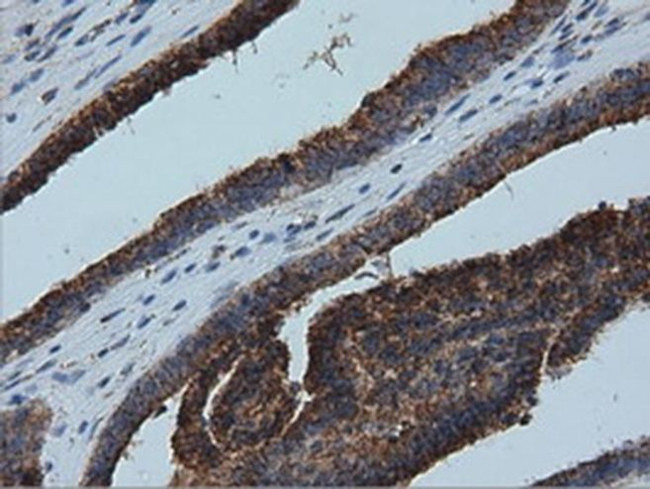 IVD Antibody in Immunohistochemistry (Paraffin) (IHC (P))