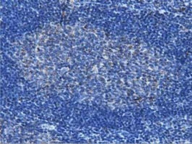 IVD Antibody in Immunohistochemistry (Paraffin) (IHC (P))