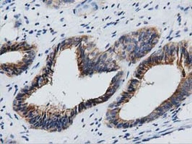 GAS7 Antibody in Immunohistochemistry (Paraffin) (IHC (P))