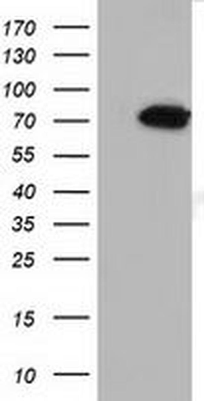 MTMR14 Antibody in Western Blot (WB)