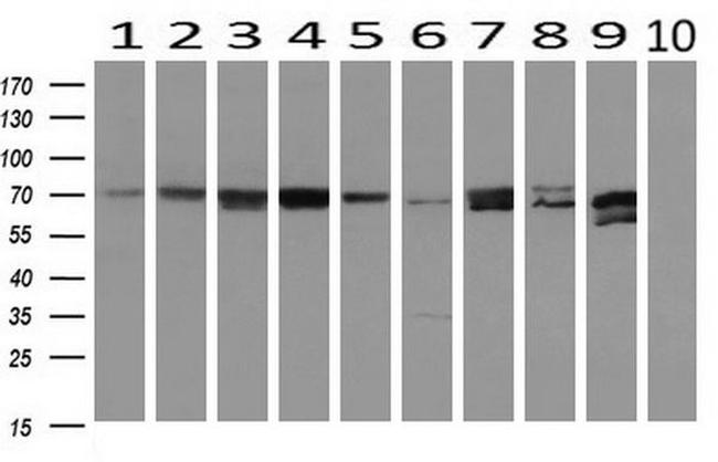 MTMR14 Antibody in Western Blot (WB)