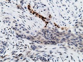 EPM2AIP1 Antibody in Immunohistochemistry (Paraffin) (IHC (P))