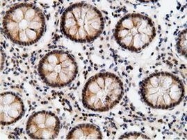 EPM2AIP1 Antibody in Immunohistochemistry (Paraffin) (IHC (P))