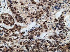 EPM2AIP1 Antibody in Immunohistochemistry (Paraffin) (IHC (P))