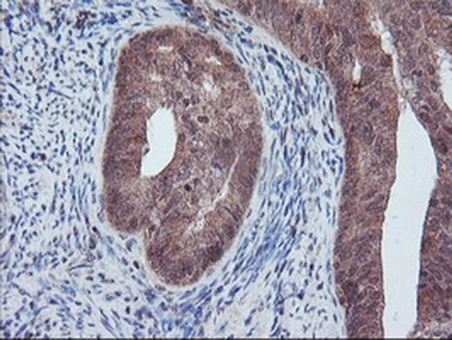 PECR Antibody in Immunohistochemistry (Paraffin) (IHC (P))