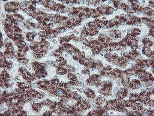 PECR Antibody in Immunohistochemistry (Paraffin) (IHC (P))