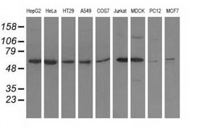 ADSL Antibody in Western Blot (WB)