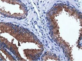 ADI1 Antibody in Immunohistochemistry (Paraffin) (IHC (P))