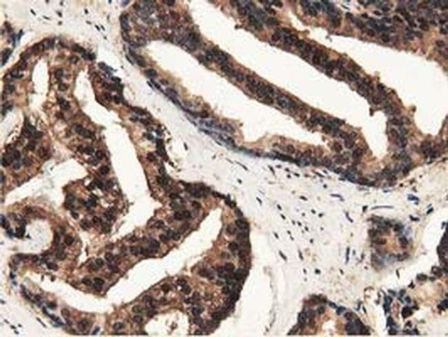 GSTT2 Antibody in Immunohistochemistry (Paraffin) (IHC (P))