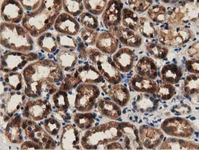 GSTT2 Antibody in Immunohistochemistry (Paraffin) (IHC (P))