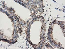 Adenylate Kinase 3 Antibody in Immunohistochemistry (Paraffin) (IHC (P))