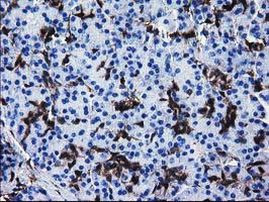 SULT1A1 Antibody in Immunohistochemistry (Paraffin) (IHC (P))