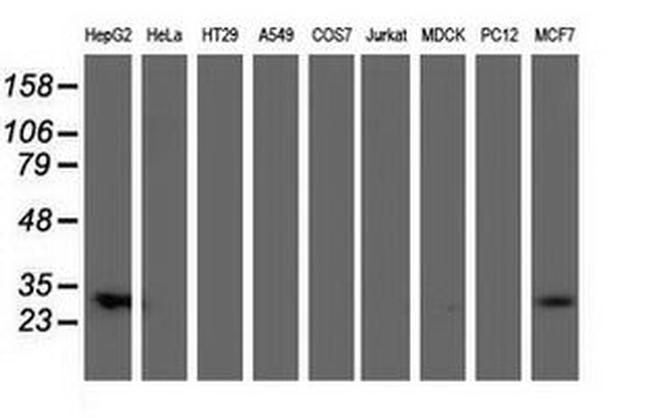 SULT1A1 Antibody in Western Blot (WB)