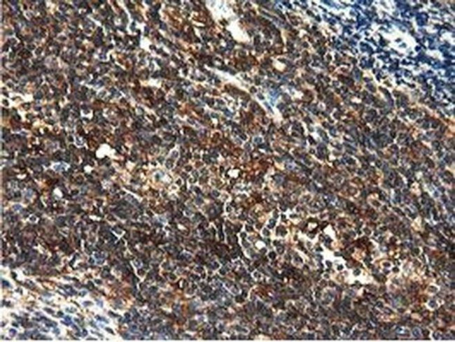 MICAL1 Antibody in Immunohistochemistry (Paraffin) (IHC (P))