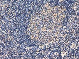 Adenylate Kinase 3 Antibody in Immunohistochemistry (Paraffin) (IHC (P))