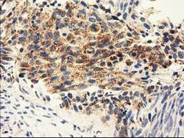 Adenylate Kinase 3 Antibody in Immunohistochemistry (Paraffin) (IHC (P))