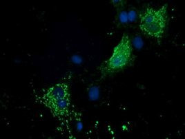 PYCR2 Antibody in Immunocytochemistry (ICC/IF)