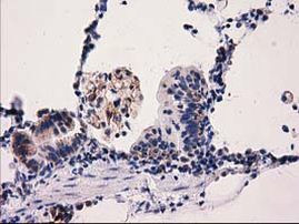 PYCR2 Antibody in Immunohistochemistry (Paraffin) (IHC (P))