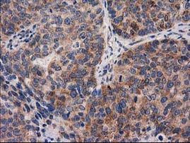 PYCR2 Antibody in Immunohistochemistry (Paraffin) (IHC (P))