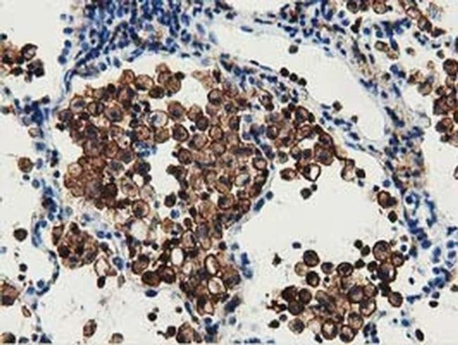 GAS7 Antibody in Immunohistochemistry (Paraffin) (IHC (P))