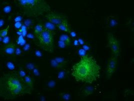 OSBPL11 Antibody in Immunocytochemistry (ICC/IF)