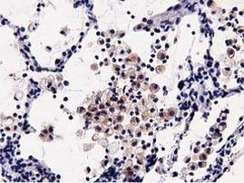 OSBPL11 Antibody in Immunohistochemistry (Paraffin) (IHC (P))