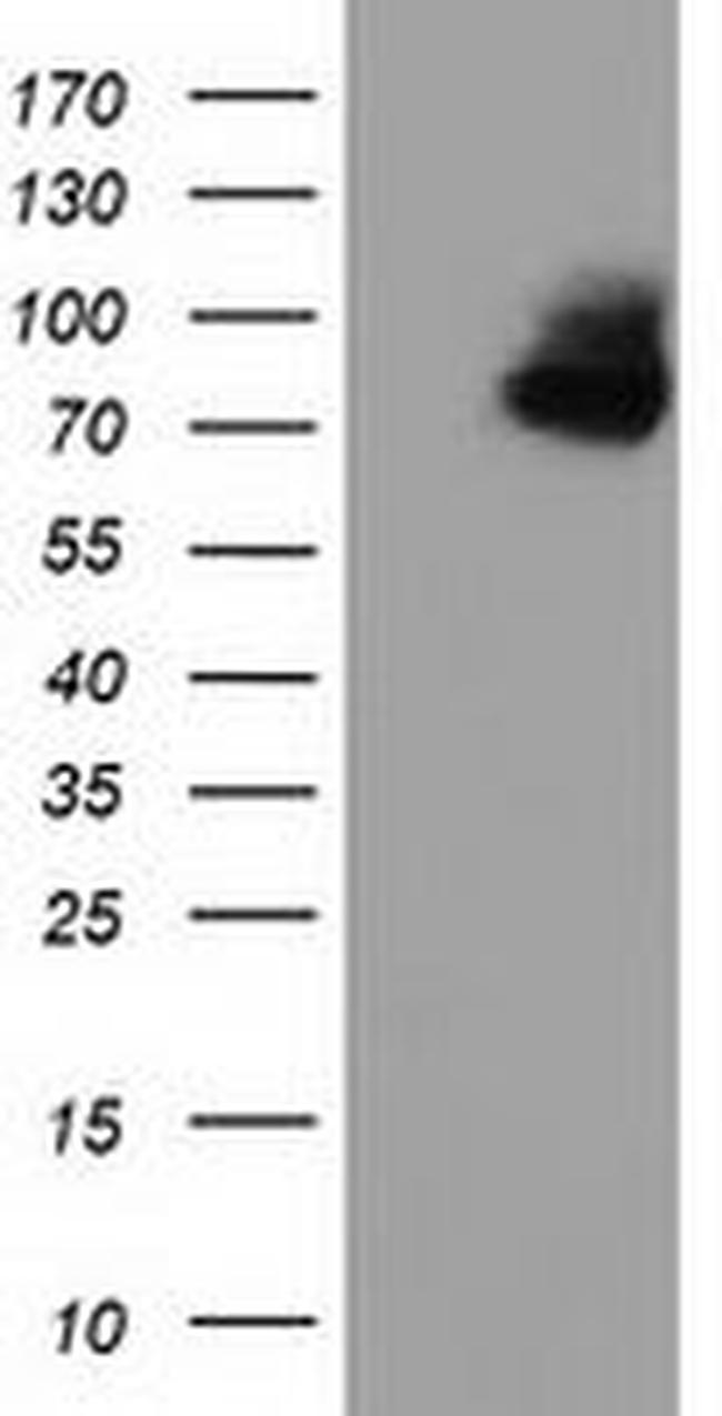 OSBPL11 Antibody in Western Blot (WB)